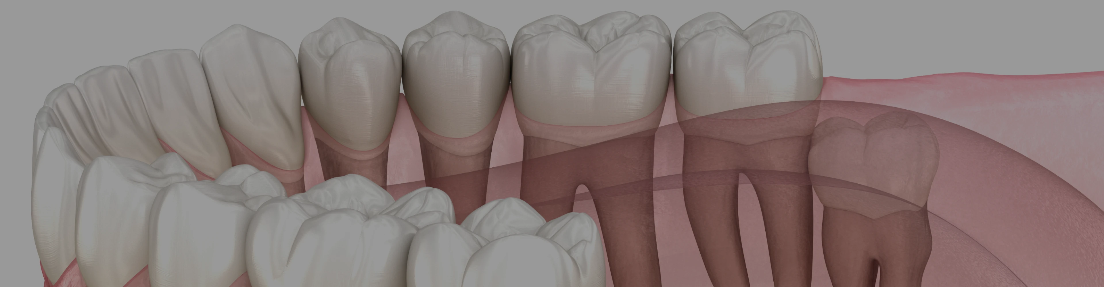 dents-sagesse-dentistes-croissy