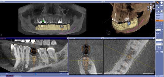 Radiographie 3D cabinet dentaire Claude Monet