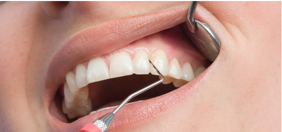 soins gencives cabinet dentaire Claude Monet