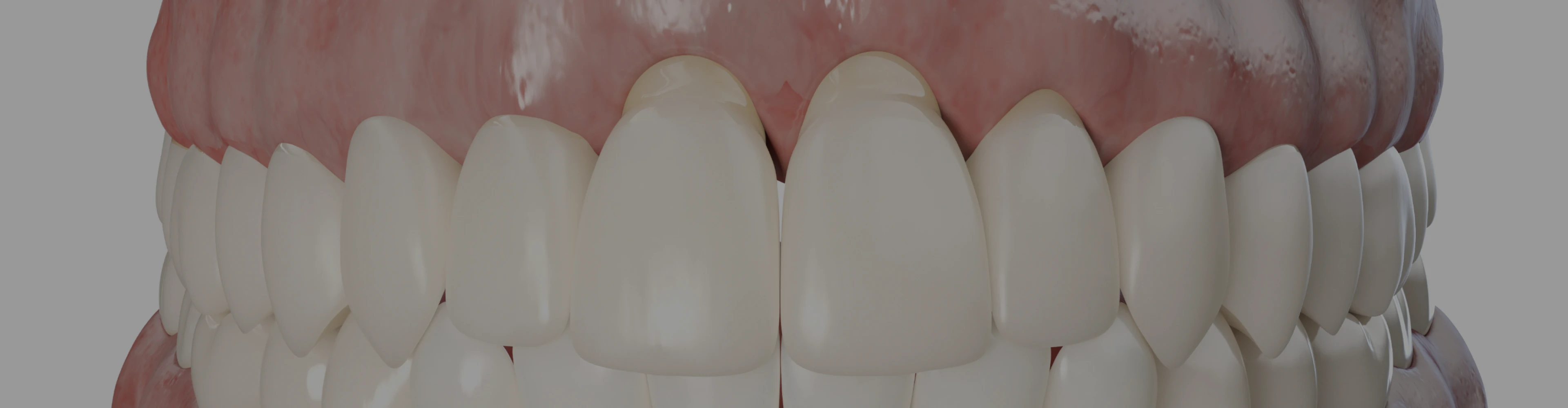 reconnaitre-traiter-recession-gingivale-dentiste