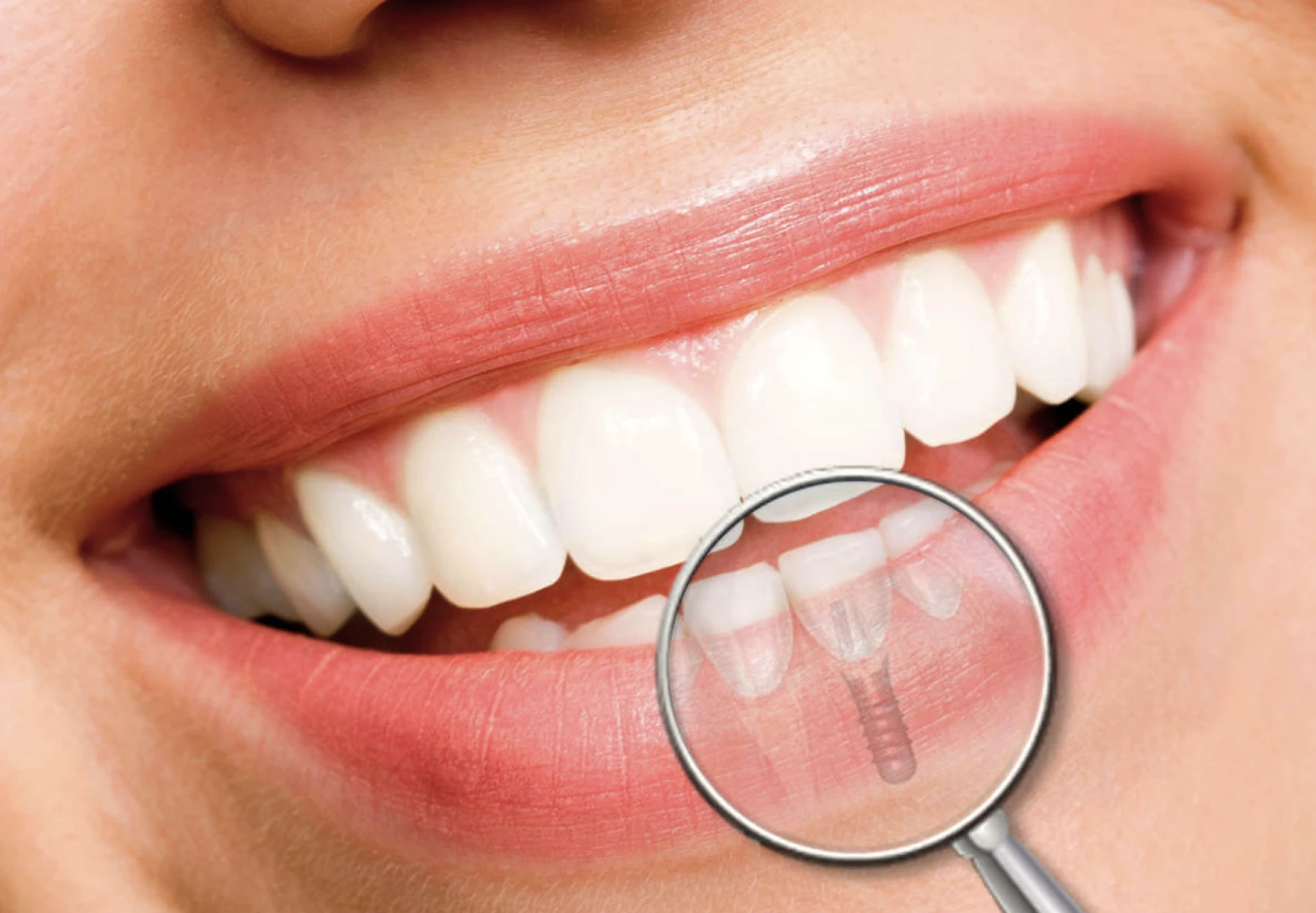 implant-dentaire croissy sur seine